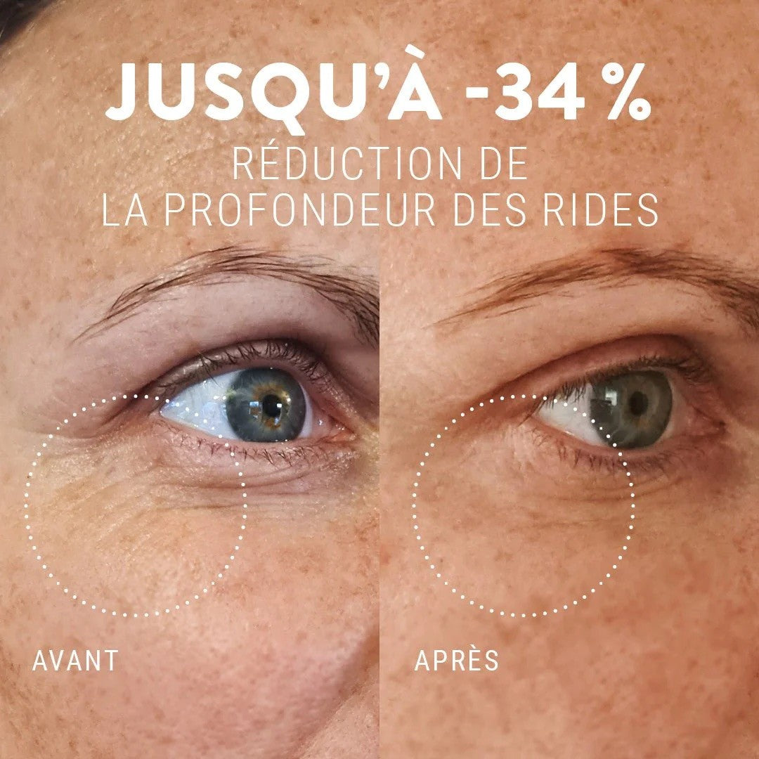 Soin contour des yeux anti cernes et rides – liftant 15ml